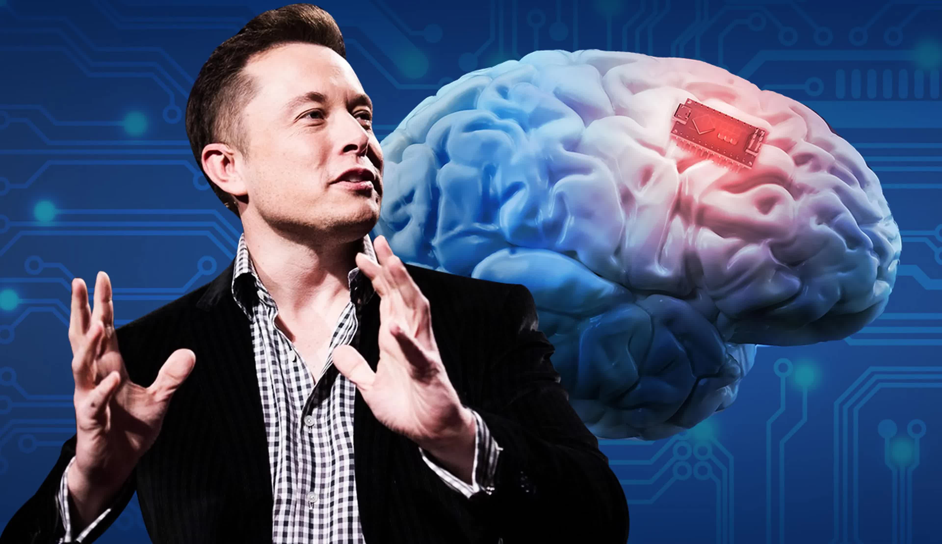 The FDA gives Elon Musk's Neuralink permission to put brain implants in humans